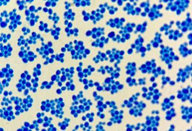 Saccharomyces_cerevisiae_Loeffler's_Methylene_Blue_Staining