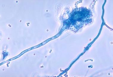 Aspergillus_fumigatus_01