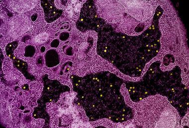Colorized_transmission_electron_micrograph_of_yellow_fever_virus_particles_(yellow)_found_within_enlarged_cytoplasmic_vesicles_of_a_C6-36_cell_(pink)