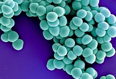 Methicillin-Resistant_Staphylococcus_Aureus_(MRSA)_Bacteria_colorized_scanning_electron_micrograph_-_22