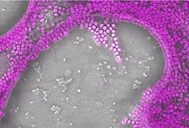Low-Res_bacteria