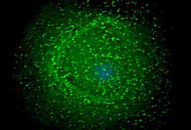 960px-HIV_on_macrophage