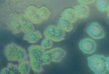 Pseudomonas_aeruginosa_on_cetrimide_agar