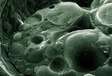 CSIRO_ScienceImage_1168_Scanning_Electron_Micrograph_of_Chytrid_Fungus
