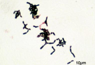 Bifidobacterium_adolescentis_Gram (1)
