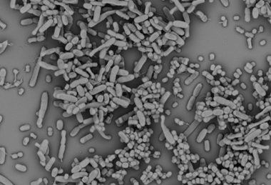 Low-Res_EM of Klebsiella pneumoniae and Acinetobacter baumannii.png