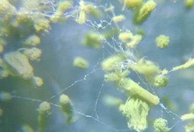 Microscope_view_of_Aspergillus_flavus_growing_on_a_leather_sample_27