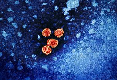 Hepatitis_B_Virus_(52444068124)