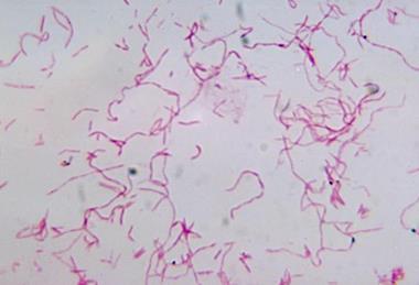 14123_2967_lores_595544_crop