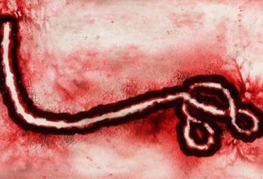 The_zoomed_out_ebolavirus_of_the_DRC_2026_OUTBREAK.webp
