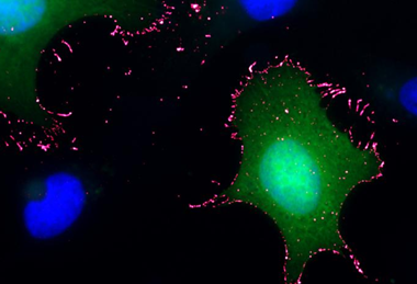 Low-Res_ANDV(green)_PCDH1(pink) 1 1