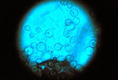 Aspergillus_nidulans_(15490521828)