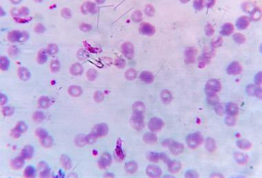 Plasmodium_falciparum_gametocyte
