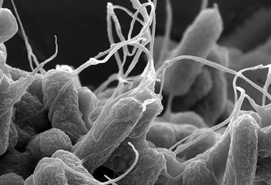 E-coli_(Escherichia_coli)