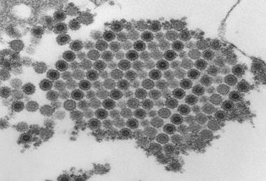 Chikungunya_virus_particles-PHIL-17369 (1)