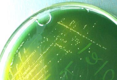 Vibrio_cholerae_on_TCBS_agar