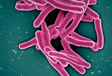 Mycobacterium_Tuberculosis_Bacteria,_the_Cause_of_TB_(52766234986)