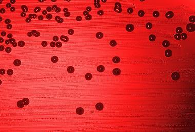 Haemophilus_influenzae_01