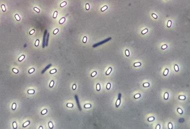 Low-Res_Endospore Bacillus (CCA-SA 3.0 Geoman3)
