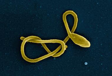 Ebola_Virus_Particle_(16436410472)