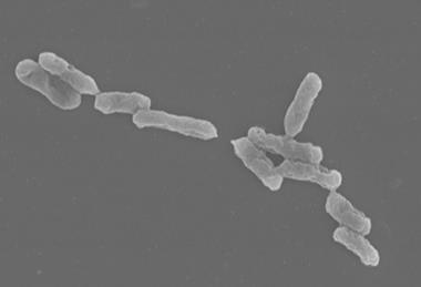Acidithiobacillus_ferrooxidans