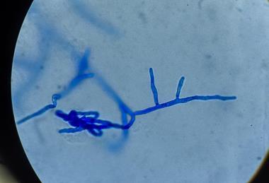Low-Res_CWB_structure_under_the_microscope
