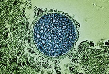 Coccidioides_Fungal_Spherule_-_12