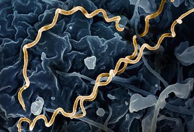 Treponema_pallidum_Bacteria_(Syphilis)