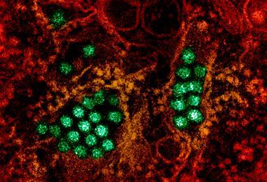 Dengue_Virus_Particles_(53231045112)