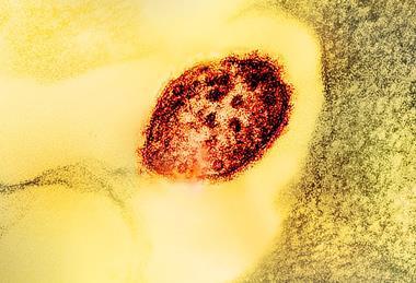 Measles_Virus_Particle
