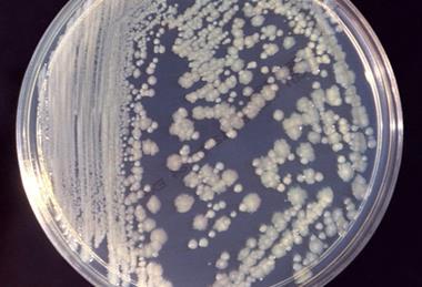Enterobacter_cloacae_01