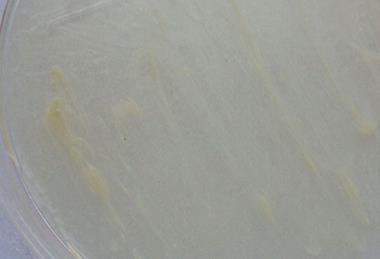 800px-Mycobacterium_abscessus