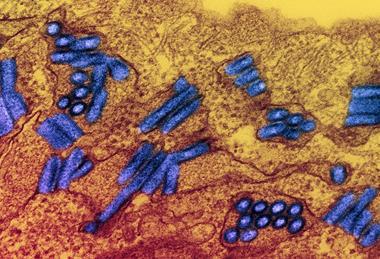 Colorized_transmission_electron_micrograph_of_rabies_virus_particles_(green)_image_captured_at_the_NIAID_Integrated_Research_Facility_in_Fort_Detrick,_Maryland_-_4