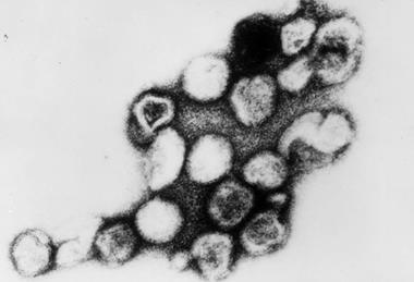 Rubella_virus_TEM_B82-0203_lores