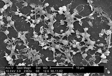 Staphylococcus_on_catheter