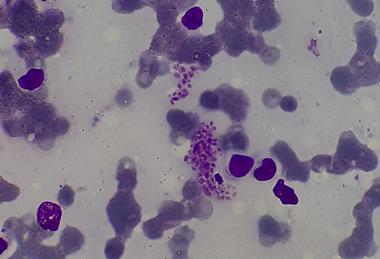 Amastigotes_of_Leishmania_donovani