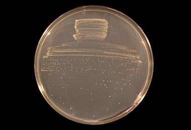 Bradyrhizobium_diazoefficiens_USDA_110_on_TY_agar