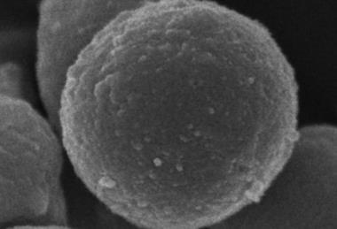 Sutterella_megalosphaeroides
