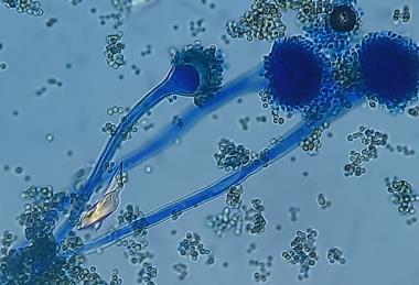 Conidia,_sterigma,_vesicle,_and_conidiophore_of_Aspergillus