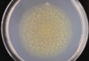 Flavobacterium johnsoniae colony