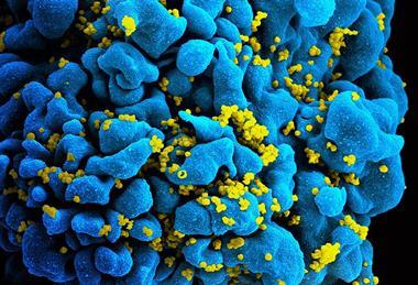 HIV-infected_T_cell_(6813384933)