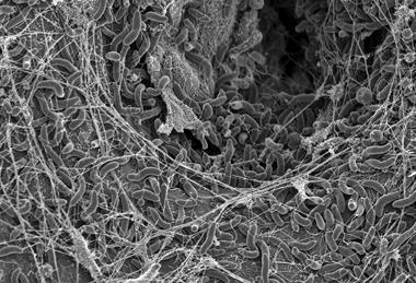 Blokesch lab SEM2