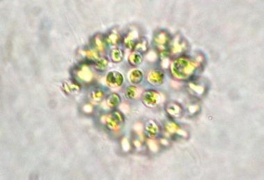 Microcystis_aeruginosa