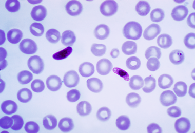Plasmodium_falciparum_01
