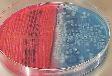 Lactose-fermenting_(LF)_strain_and_non-lactose_fermenting(NLF)_strain_of_E._coli_colony_morphology_on_CLED_medium