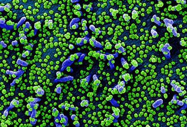 Novel_Coronavirus_SARS-CoV-2_(49680676102)