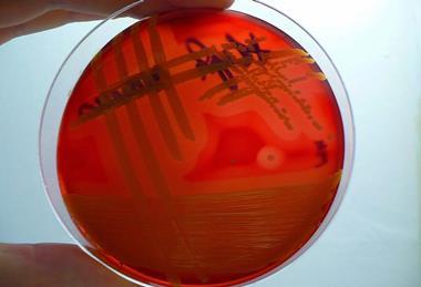 Staphylococcus_aureus-blood_agar-_hemolysis_detail
