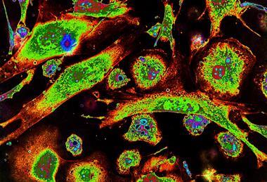 Epithelioid_cells_and_macrophages_in_cell_culture