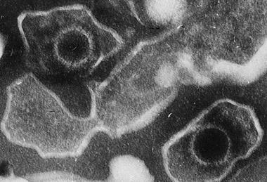 Epstein_Barr_Virus_virions_EM_10.1371_journal.pbio.0030430.g001-L