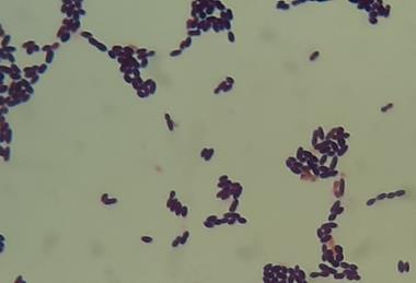 Enterococcus_faecium_in_Gram_Staining_of_culture